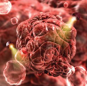 Cancro: con la nanomedicina potremo conviverci, e forse domani anche guarire