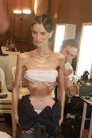 Moda, modelle e ANORESSIA! La ragazza scheletrica