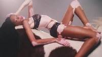 Winnie Harlow, prima modella con la vitiligine: «A scuola mi chiamavano Zebra»