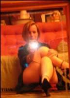 Una rarissima malattia sta colpendo Donna Glover, 40enne inglese